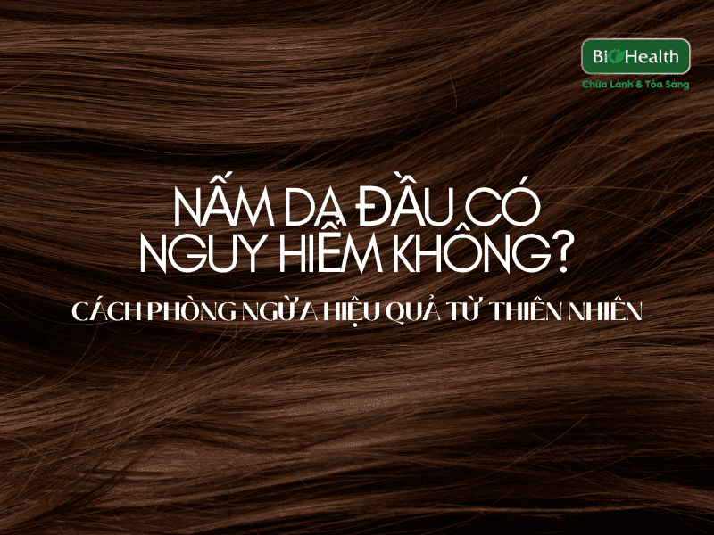 NẤM DA ĐẦU CÓ NGUY HIỂM KHÔNG? CÁCH PHÒNG NGỪA HIỆU QUẢ TỪ THIÊN NHIÊN